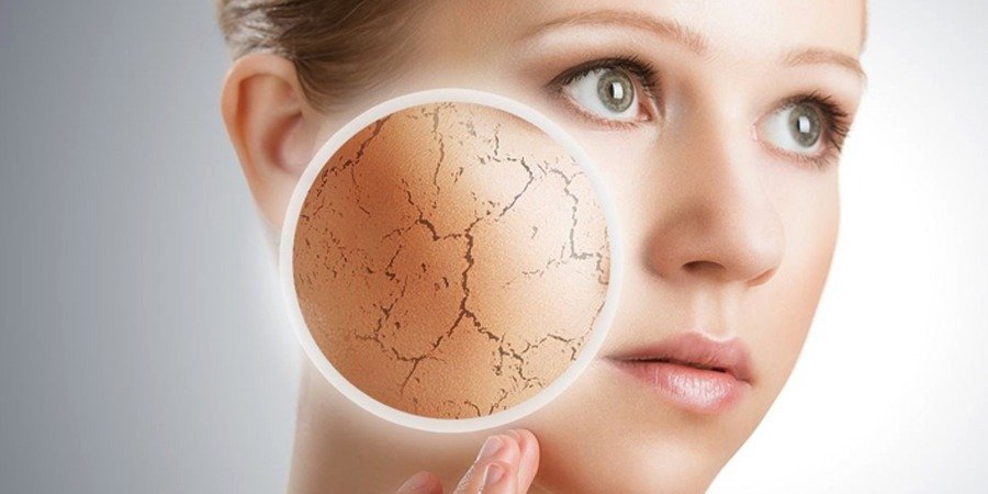 Сухая кожа лица — возможные причины