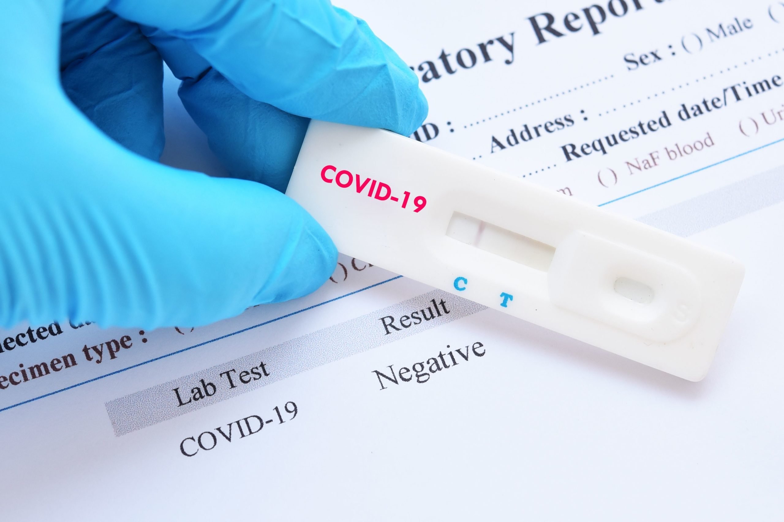 Впервые за длительное время на Херсонщине менее полусотни новых случаев COVID-19