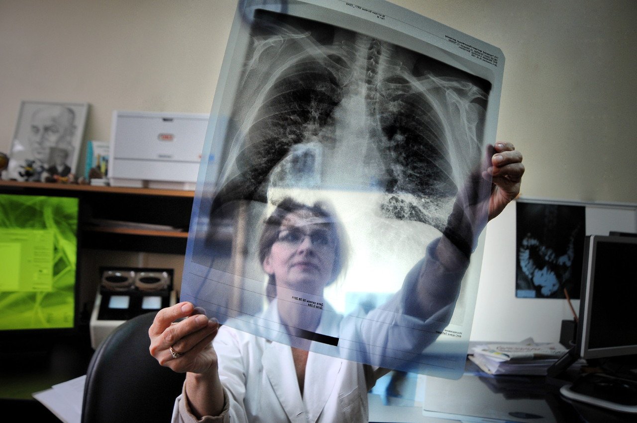 Без вакцины: как на Херсонщине складывается ситуация с туберкулезом